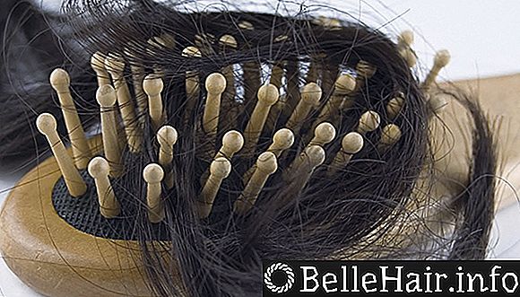 10 причин облысения мужчин и женщин лечение и уход